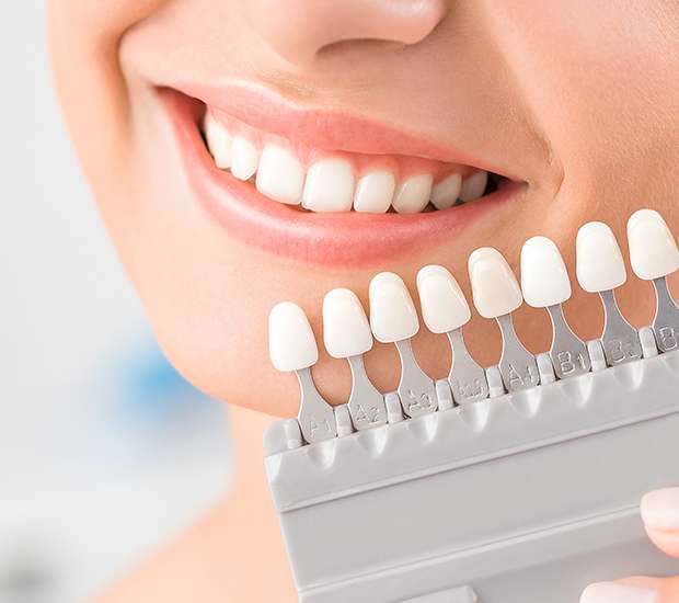 Ridgewood Dental Veneers and Dental Laminates