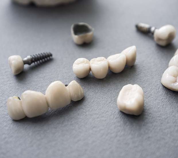 Ridgewood The Difference Between Dental Implants and Mini Dental Implants