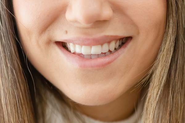 Smile Makeover Options For Damaged Teeth
